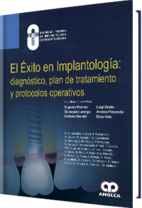 Producto El Éxito en Implantología: Diagnóstico