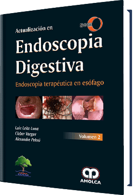 Producto Actualización en Endoscopia Digestiva / Endoscopia terapéutica en esófago de Autor del año 2018 ISBN 9789585426207
