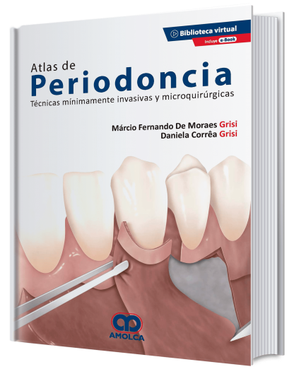 Producto Atlas de periodoncia. Técnicas mínimamente invasivas y microquirúrgicas de Autor del año 2020 ISBN 9789585598652