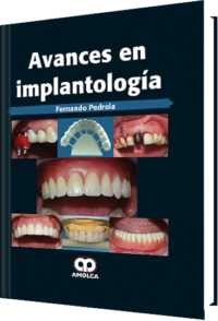 Producto Avances en Implantología de Autor del año 2016 ISBN 9789585911338