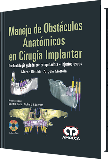 Producto Manejo de Obstáculos Anatómicos en Cirugía Implantar de Autor del año 2011 ISBN 9789587550238