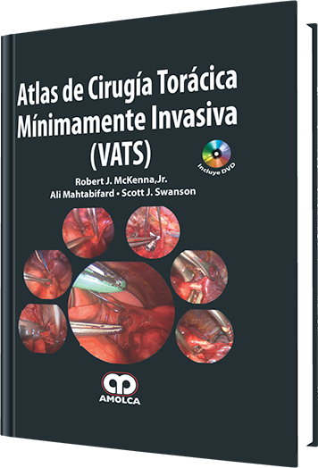 Producto Atlas de Cirugía Torácica Mínimamente Invasiva (VATS) de Autor del año 2012 ISBN 9789587550757