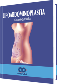 Producto Lipoabdominoplastia de Autor del año 2007 ISBN 9789588328058