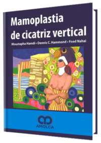 Producto Mamoplastia de Cicatriz Vertical de Autor del año 2007 ISBN 9789588328072