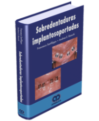 Producto Sobredentaduras Implantosoportadas de Autor del año 2007 ISBN 9789588328096