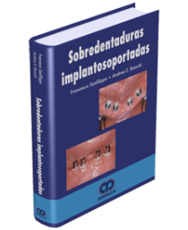Producto Sobredentaduras Implantosoportadas de Autor del año 2007 ISBN 9789588328096