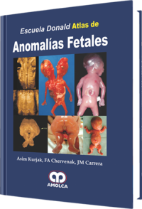 Producto Escuela de Donald (Donald School) Atlas de Anomalías Fetales de Autor del año 2008 ISBN 9789588328546