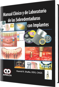 Producto Manual Clínico y de Laboratorio de las Sobredentaduras con Implantes de Autor del año 2009 ISBN 9789588473161