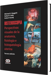 Producto Histeroscopia / Tercera edición de Autor del año 2009 ISBN 9789588473208