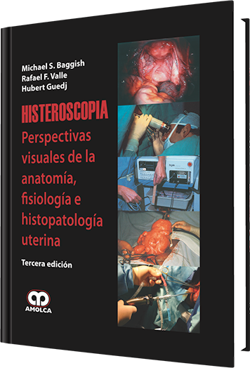 Producto Histeroscopia / Tercera edición de Autor del año 2009 ISBN 9789588473208