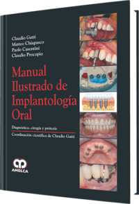 Producto Manual Ilustrado de Implantología Oral de Autor del año 2010 ISBN 9789588473260