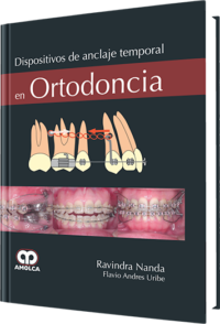 Producto Dispositivos de Anclaje Temporal en Ortodoncia de Autor del año 2010 ISBN 9789588473451