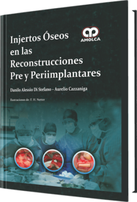 Producto Injertos Óseos en las Reconstrucciones Pre y Periimplantares de Autor del año 2013 ISBN 9789588760063