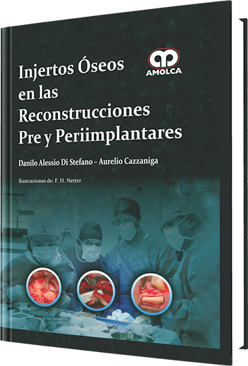 Producto Injertos Óseos en las Reconstrucciones Pre y Periimplantares de Autor del año 2013 ISBN 9789588760063
