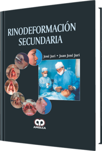 Producto Rinodeformación Secundaria de  del año  ISBN 9789588760117