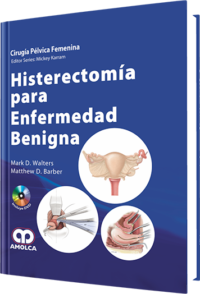 Producto Histerectomía para Enfermedad Benigna de Autor del año 2012 ISBN 9789588760155