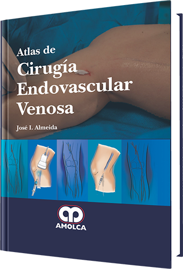 Producto Atlas de Cirugía Endovascular Venosa de Autor del año 2013 ISBN 9789588760506