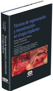 Producto Técnicas de Regeneración y Reconstrucción en Cirugía Implantar de Autor del año 2013 ISBN 9789588760874