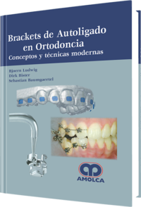 Producto Brackets de Autoligado en Ortodoncia de Autor del año 2015 ISBN 9789588816791