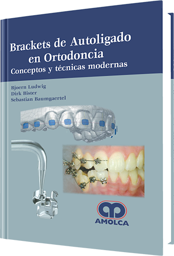 Producto Brackets de Autoligado en Ortodoncia de Autor del año 2015 ISBN 9789588816791