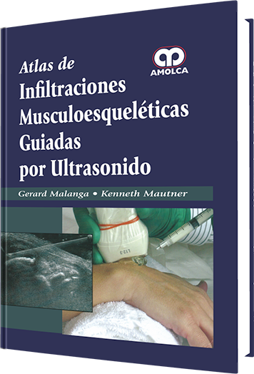 Producto Atlas de Infiltraciones Musculoesqueléticas Guiadas por Ultrasonido de Autor del año 2015 ISBN 9789588871547
