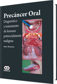 Producto Precáncer Oral / Diagnóstico y tratamiento de lesiones potencialmente maligna de Autor del año 2015 ISBN 9789588871585