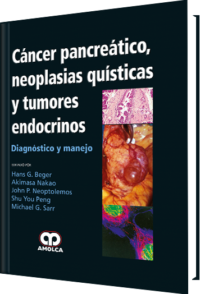 Producto Cáncer Pancreático