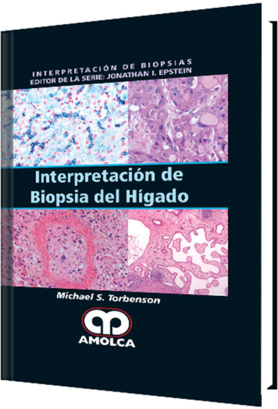 Producto Interpretación de Biopsia del Hígado de Autor del año 2017 ISBN 9789588950389