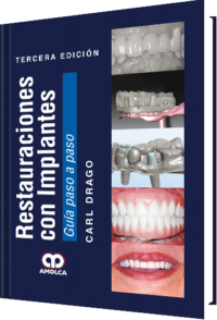 Producto Restauraciones con Implantes / Tercera edición de Autor del año 2017 ISBN 9789588950440