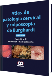 Producto Atlas de Patología Cervical y Colposcopia de Burghardt de Autor del año 2017 ISBN 9789588950556