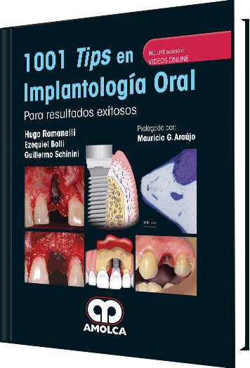 Producto 1001 Tips en Implantología Oral de Autor del año 2017 ISBN 9789588950990