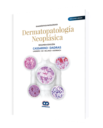 Producto Diagnóstico Patológico Dermatopatología Neoplásica de Autor del año 2019 ISBN 9789804300431