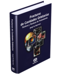 Producto Fracturas de Cavidades Orbitarias de Autor del año 2006 ISBN 9789806574354