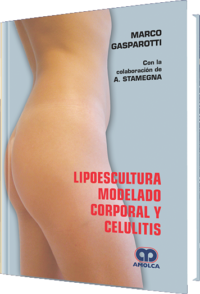 Producto Lipoescultura