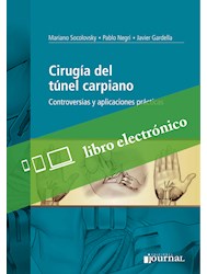 Ebook: Cirugía del túnel carpiano- controversias y aplicaciones prácticas ISBN 9789873954757 Idioma Español Editorial Journal