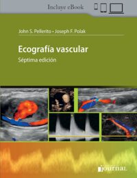 Ebook: Ecografía Vascular (Ebook) ISBN 9789874922885 Idioma Español Editorial Journal