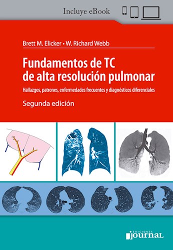 Ebook: Fundamentos de TC de alta resolución pulmonar Ed.2 (Ebook) ISBN 9789874922984 Idioma Español Editorial Journal