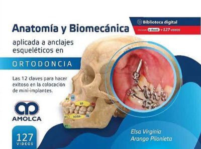 Libro Anatomía y Biomecánica Aplicada a Anclajes Esqueléticos en Ortodoncia. 12 Claves en el Éxito en la Colocación de Mini-Implantes ISBN 9789585303782 Idioma Español Editorial Amolca