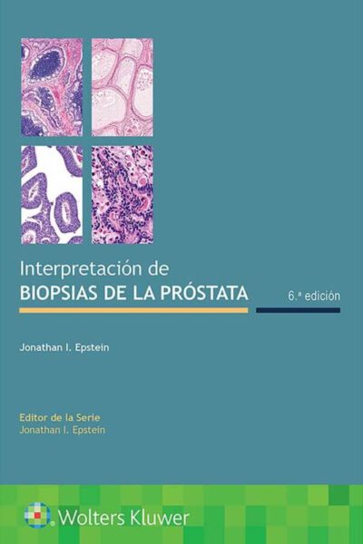 Libro Interpretación de Biopsias de la Próstata. 6° Edición. ISBN 9788418257285 Idioma Español Editorial Lippincott W & W
