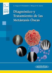Libro Diagnóstico y Tratamiento de las Metástasis Óseas. ISBN 9788491107804 Idioma Español Editorial Panamericana