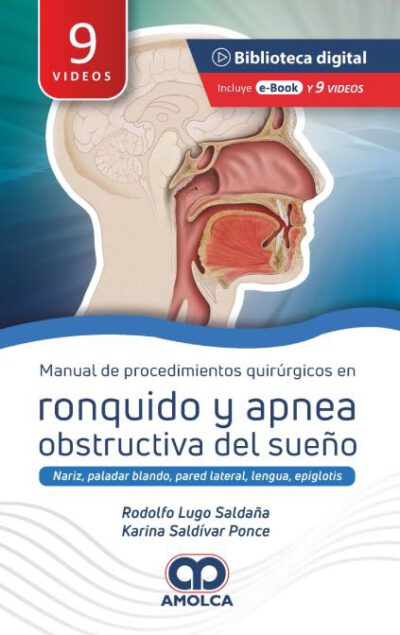 Libro Manual de Procedimientos Quirúrgicos en Ronquido y Apnea Obstructiva del Sueño. Nariz