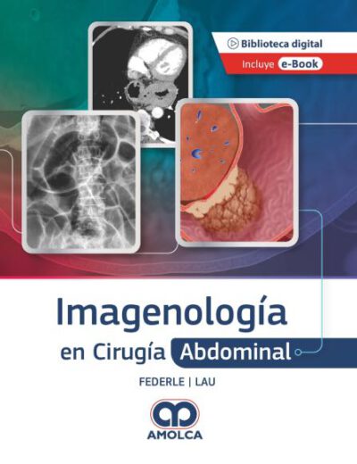 Libro Imagenología en Cirugía Abdominal. ISBN 9789585348837 Idioma Español Editorial Amolca