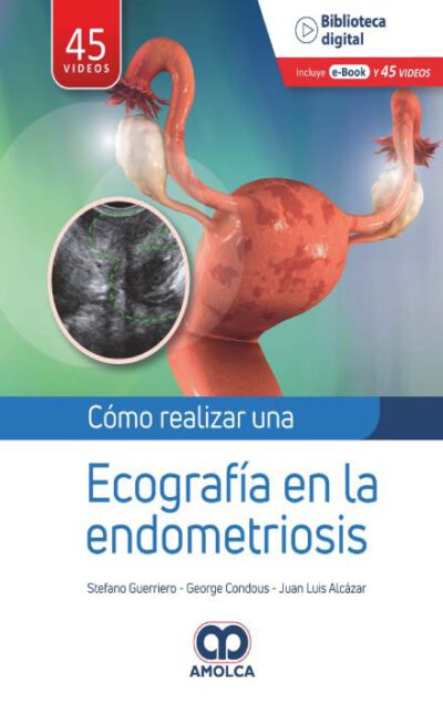 Libro Como Realizar una Ecografía en la Endometriosis. ISBN 9789585348950 Idioma Español Editorial Amolca