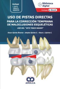 Libro Uso de Pistas Directas para la Corrección Temprana de Maloclusiones Esqueleticas. ISBN 9789585349254 Idioma Español Editorial Amolca